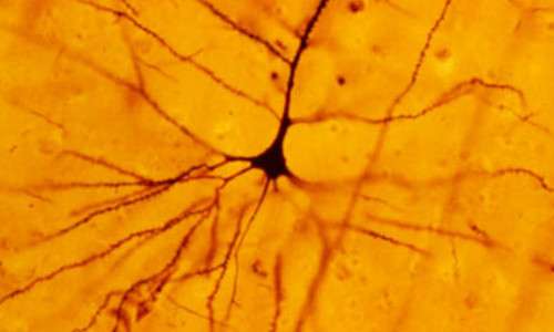 Un neurone può essere reso visibile all'interno di un cervello mediante la colarazione di Golgi