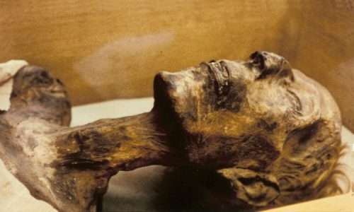 Il vaccino ha permesso di debellare il vaiolo, considerato causa della morte di Ramses IV la cui mummia porta i segni di un'infezione.