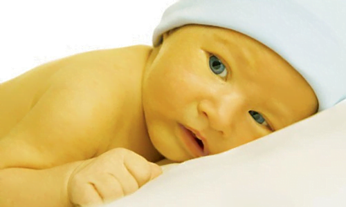 La sindrome di gilbert nei neonati potrebbe comportare livelli di bilirubina pericolosi