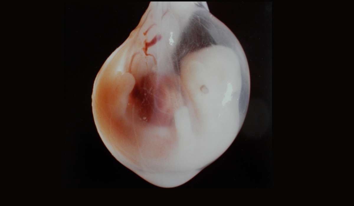 L'embrione dei mammiferi placentati è definito come quell'organismo che si sviluppa partendo con il nome di gastrula.