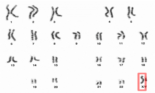 Il cromosoma x è un cromosoma sessuale