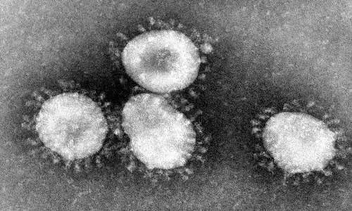 Micrografia elettronica del nuovo coronavirus. Sono evidenti le proteine spike che protendono dal capside del virus.
