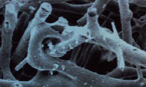 Struttura microporosa dell'aerogel