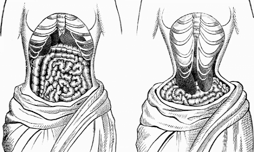 Quando fa male il fegato ? le donne con il corsetto non si accorgevano che si deformava il fegato