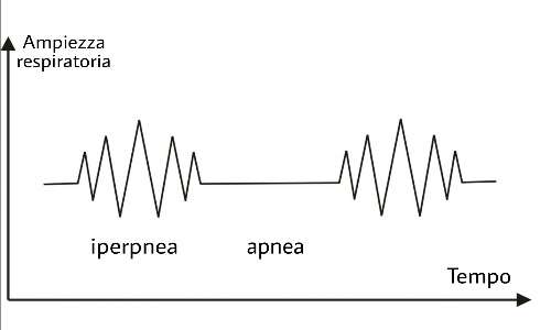 Il respiro del paziente alterna fasi di apnea a fasi di iperpnea.