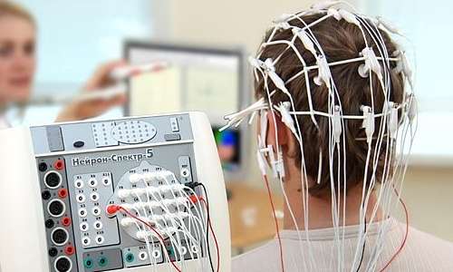 L'EEG è un passo necessario per la diagnosi di epilessia fotosensibile.