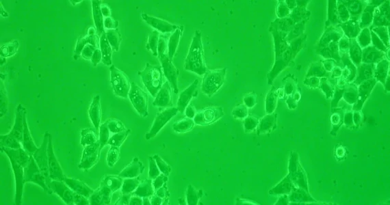 Cellule HeLa osservate al microscopio a contrasto di fase, con dettagli delle strutture cellulari visibili.