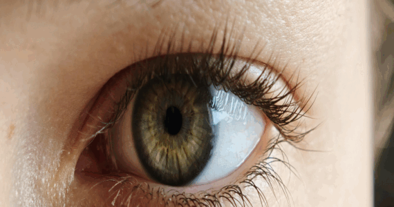 La fotografia mostra l'occhio sano di una giovane donna non affetta da retinopatia diabetica. Nella retinopatia diabetica sintomi si manifestano quando la retina è già danneggiata.